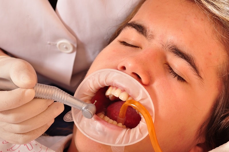 wzrastające ceny usług stomatologicznych