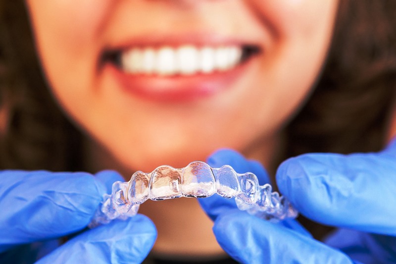 Aspekty leczenia nakładkami ortodontycznymi