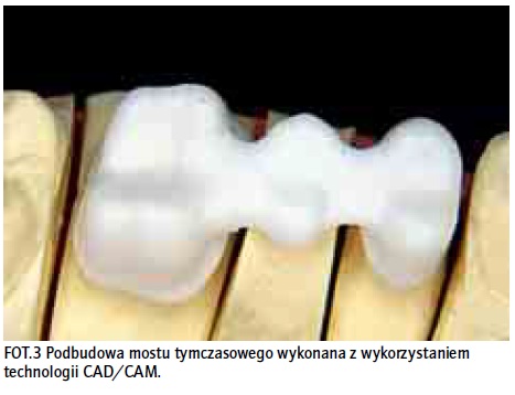 uzupełnienia tymczasowe 2