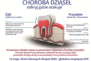 choroba dziasel atakuje min